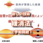 ウチに通えない膝痛の民を緩消法で救ってみた！
