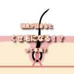頭皮の汚れが詰まってくるとくせ毛になる！？