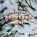 頭皮の乾燥でフケや荒れが気になってくるとカラーができなくなるよ