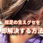 襟足の生えぐせを即解決できる方法